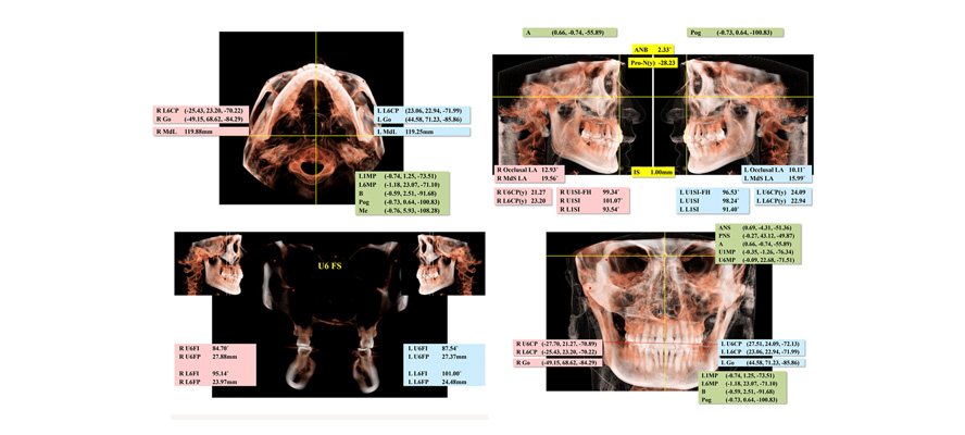 미소에 딱 맞는 교정치료