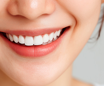 환자 만족도 향상