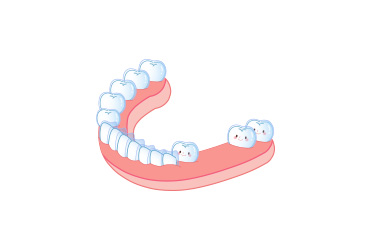 유치가 일찍 빠진 경우