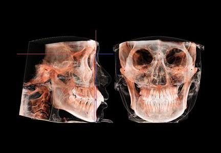 진단 자료 수집