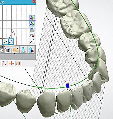 Customized Treatment