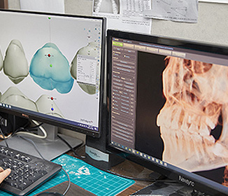 최적의 교합으로 치아배열