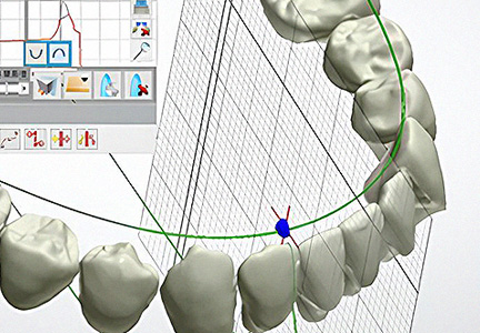 Customized Treatment
